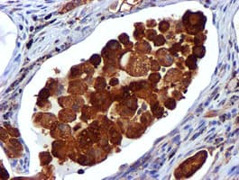 USP7 / HAUSP Antibody (clone OTI1B2)