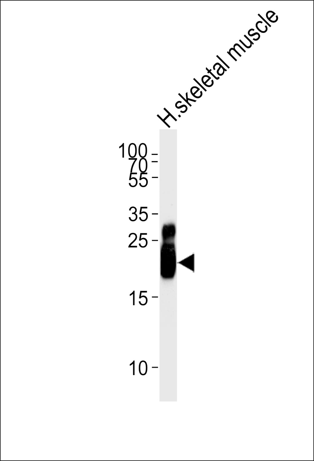 Polyclonal Rabbit anti-Human TNNI2 Antibody (aa1-30, WB)