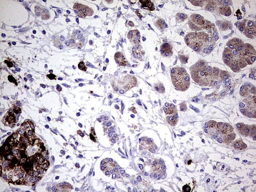 GBA / Glucosidase Beta Acid Antibody (aa40-315, clone UMAB171)