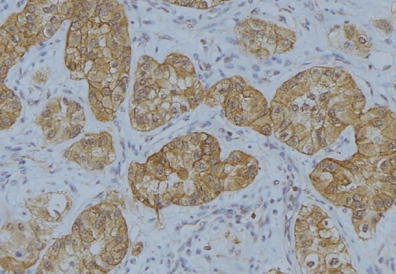 IL13 Antibody
