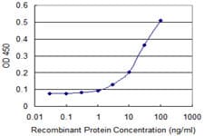 IHC-plus™ Monoclonal Mouse anti-Human NDRG4 Antibody (clone 2G3, IHC, WB)