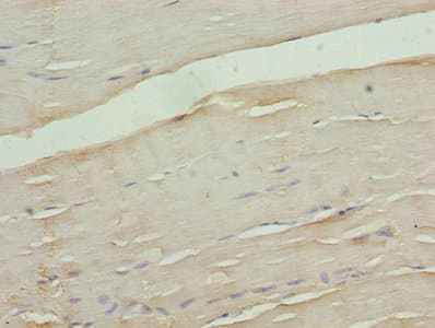 CACNA2D1 Antibody (aa528-668)