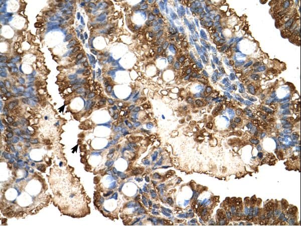 PGK1 / Phosphoglycerate Kinase Antibody (aa301-350, Biotin)