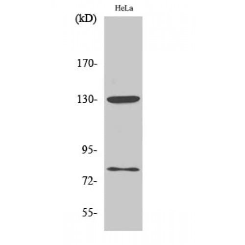 Polyclonal Rabbit anti-Human ADD1 + ADD2 Antibody (670-750 aa, IHC, IF, WB)