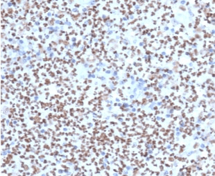 SPI1 / PU.1 Antibody (clone TFPU1-1)