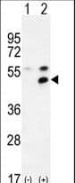 Polyclonal Rabbit anti-Human MPP1 Antibody (aa301-327, IHC, WB)