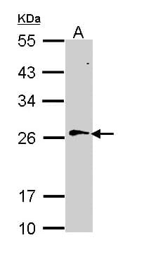 RAN Antibody