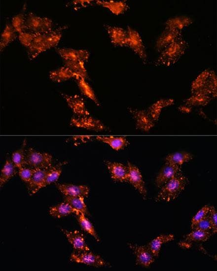 HSPC167 / CDK5RAP1 Antibody