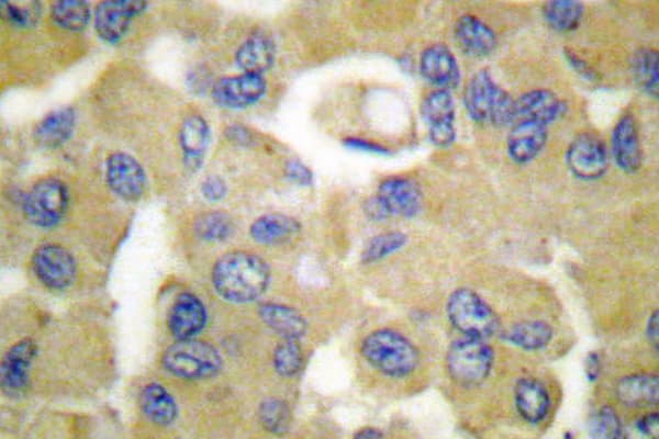Polyclonal Rabbit anti-Human KRT15 / CK15 / Cytokeratin 15 Antibody (Thr12, IHC, WB)