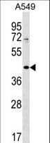 Polyclonal Rabbit anti-Human ZNF25 Antibody (aa54-81, WB)
