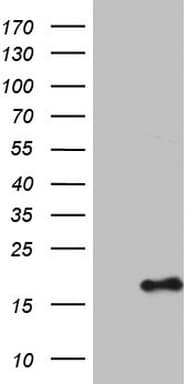IL1RN Antibody (clone OTI2D2)