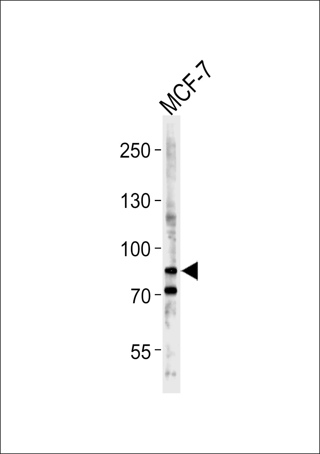 BCAS3 Antibody (aa835-865)
