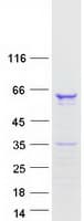 Human FAM90A1 Protein (Recombinant Myc-DDK (Flag))