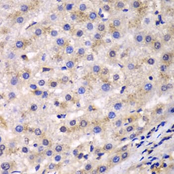 EEF2 / Elongation Factor 2 Antibody