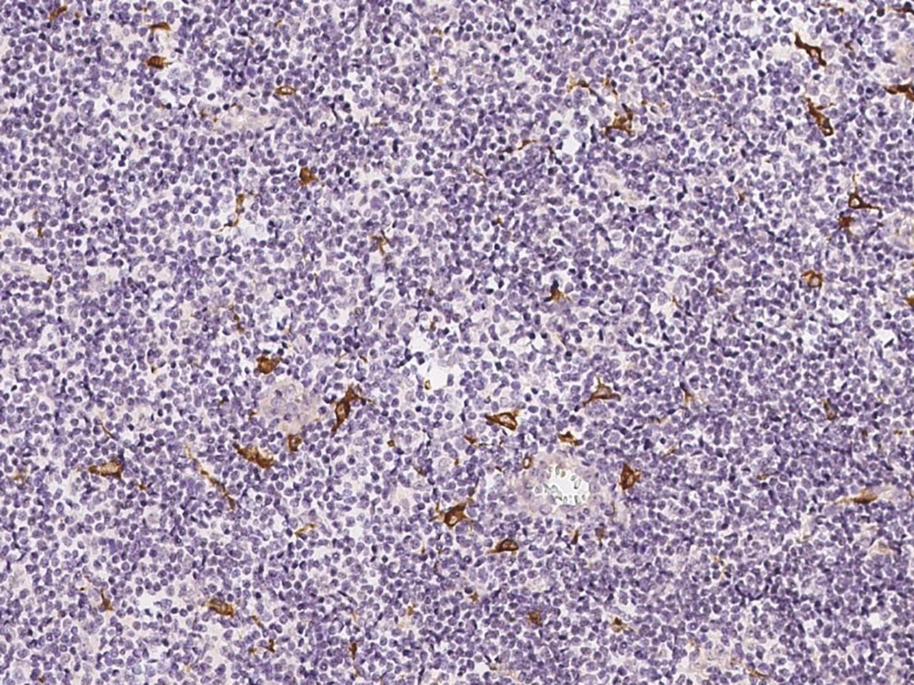 TIMD4 / TIM4 / TIM-4 Antibody