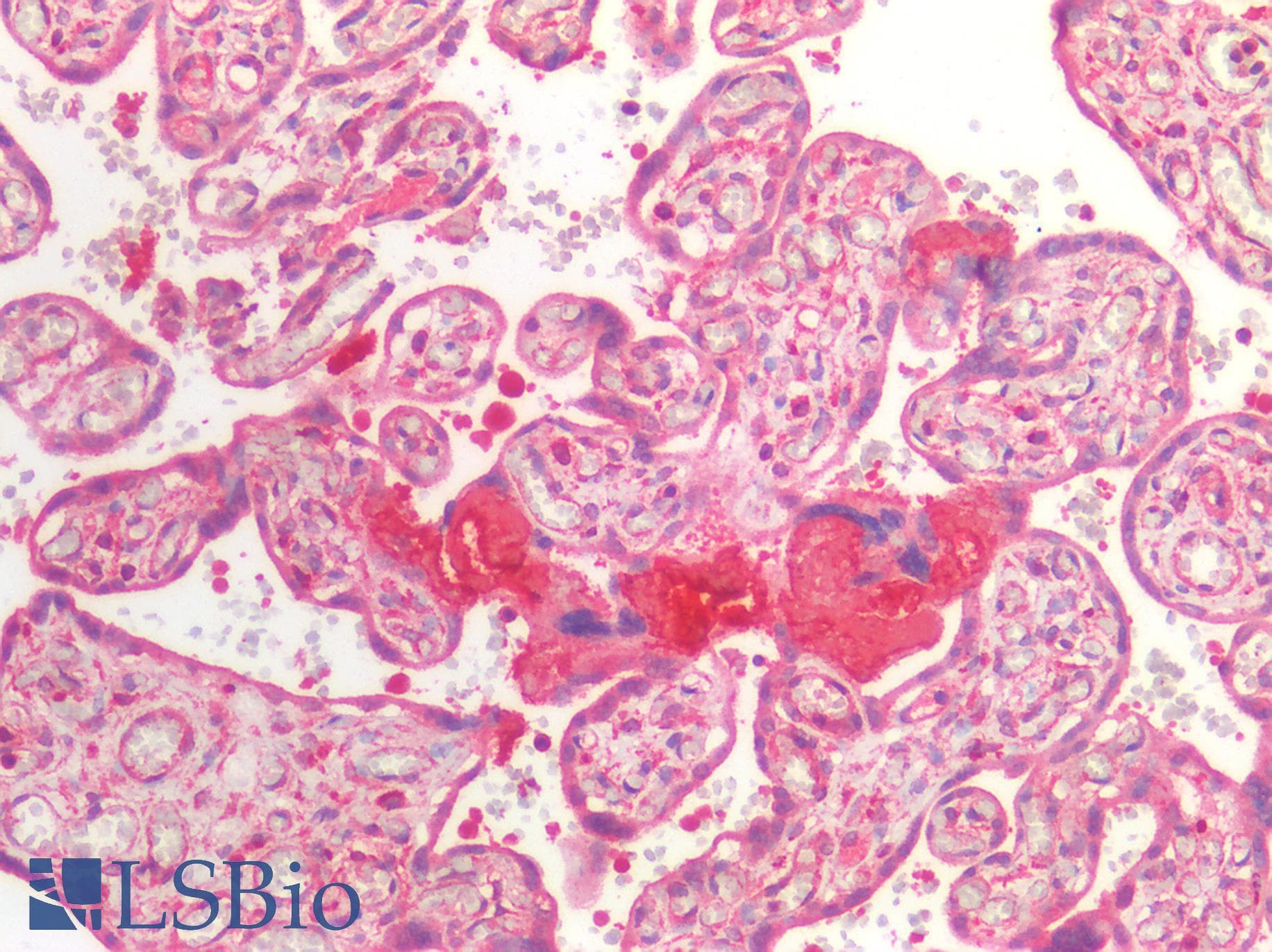 PathPlus™ Polyclonal Rabbit anti-Human BCL2 / Bcl-2 Antibody (IHC)