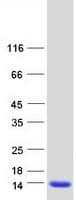 Human RETN / Resistin Protein (Recombinant Myc-DDK (Flag))