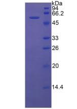 Rat High Molecular Weight Kininogen Protein (Recombinant His-GST, N-terminus)