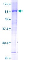Human RHOBTB3 Protein (Recombinant GST)