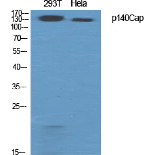SRCIN1 / SNIP Antibody (780-860 aa, Internal)