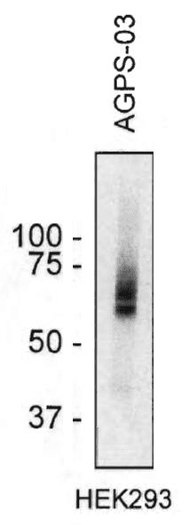 AGPS Antibody (clone AGPS-03)