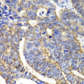 CLDN1 / Claudin 1 Antibody