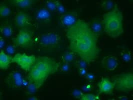ACAT2 Antibody (clone OTI1C5)