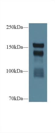 THBS1 / Thrombospondin-1 Antibody (aa511-670)