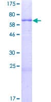 Human KCTD7 Protein (Recombinant GST)