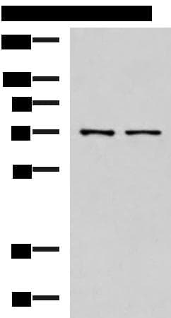 Polyclonal Rabbit anti-Human MKS1 Antibody (IHC, WB)