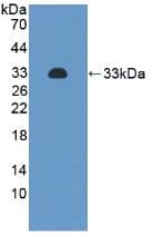 ITGA2 / CD49b Antibody (aa170-361)