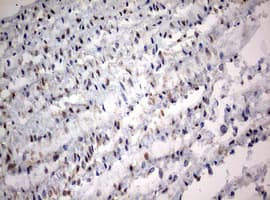 NUMB Antibody (aa1-365, clone OTI3E5)