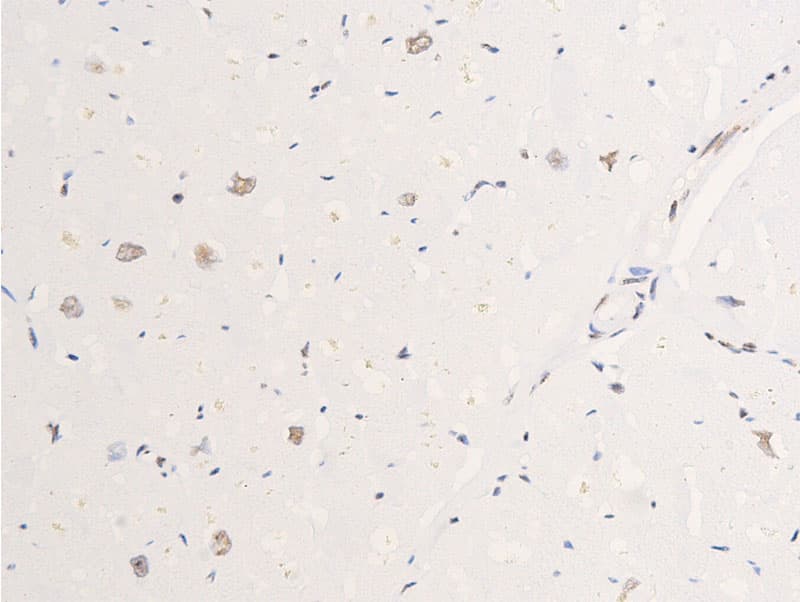 EGFR Antibody (phospho-Ser695)