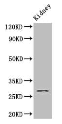 GSTM3 Antibody