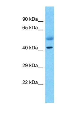Polyclonal Rabbit anti-Human ZNF114 Antibody (C-Terminus, WB)