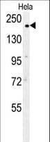 Polyclonal Rabbit anti-Human CLTC / Clathrin Heavy Chain Antibody (aa1019-1048, IHC, WB)