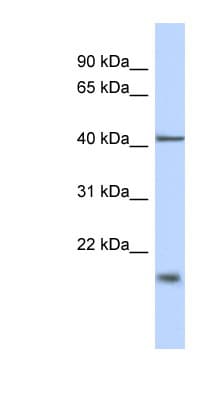 Polyclonal Rabbit anti-Human TBC1D21 Antibody (N-Terminus, WB)