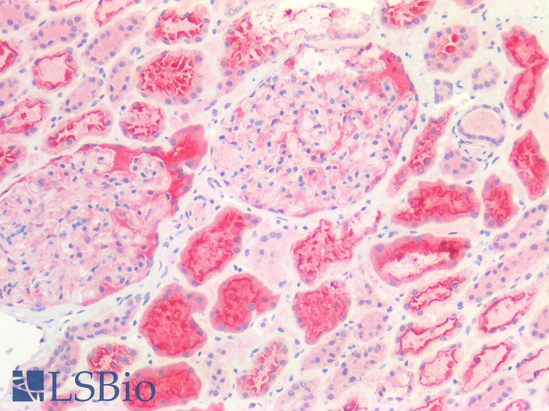 IHC-plus™ Polyclonal Rabbit anti-Human SLC6A3 / Dopamine Transporter Antibody (IHC)