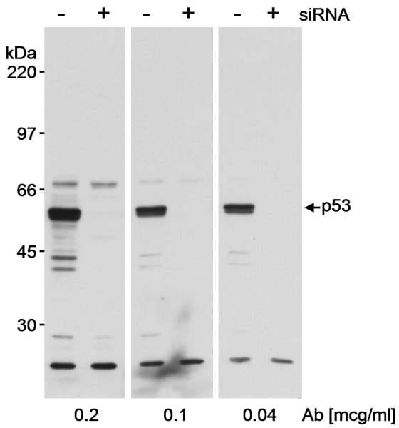 TP53 / p53 Antibody (aa325-375)