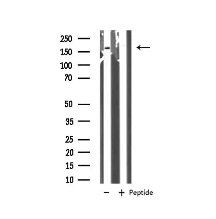 ARHGAP35 / GRLF1 Antibody