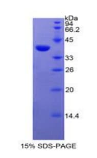 Human EGFR Protein (Recombinant His-S)