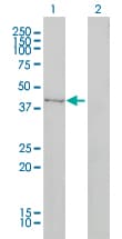 TRDMT1 / DNMT2 Antibody (clone 1E12)