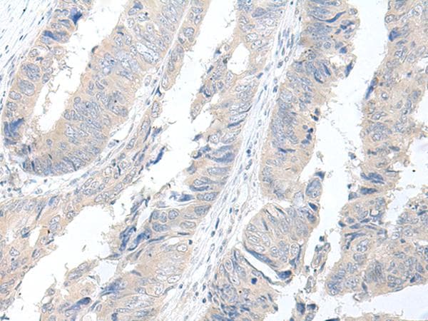 GBA2 Antibody