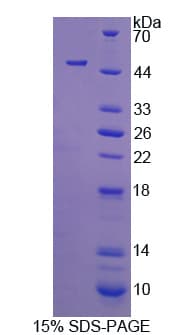 Human CYTH4 / PSCD4 Protein (Recombinant His-T7)