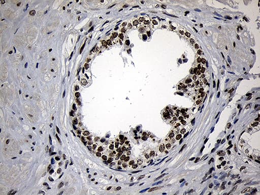 Monoclonal Mouse anti-Human ZNF670 Antibody (clone OTI3E1, IHC, WB)
