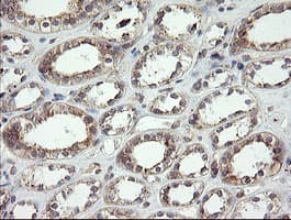 UBE2J1 Antibody (clone OTI1C7)