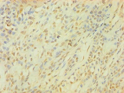 SNCG / Gamma-Synuclein Antibody (aa1-127)