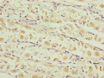 TIMM17B Antibody