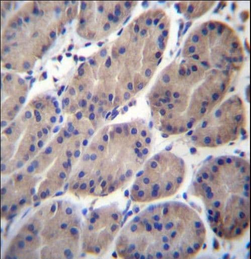 Polyclonal Rabbit anti-Human CTTNBP2NL Antibody (aa135-164, IHC, WB)