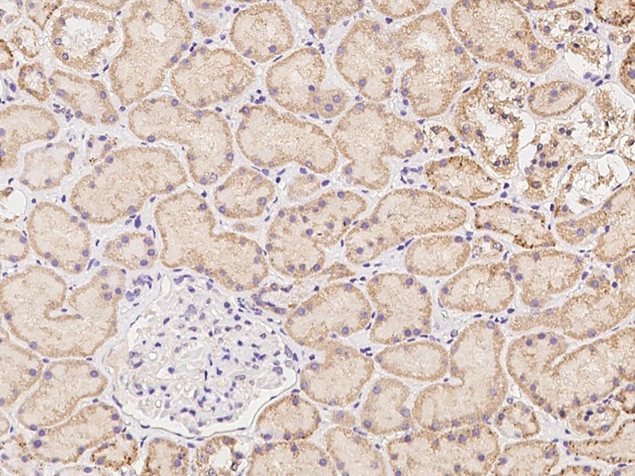 Polyclonal Rabbit anti-Human NXNL2 Antibody (IHC)